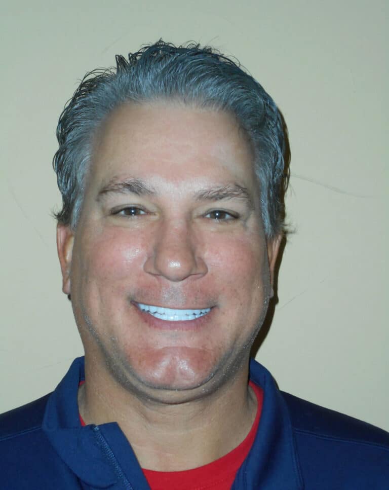 After Image: Full Upper and Lower Crowns - front