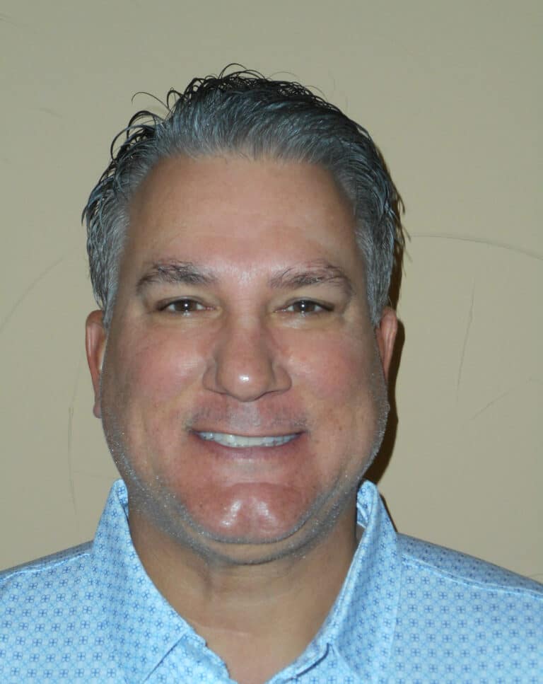 Before Image: Full Upper and Lower Crowns - front